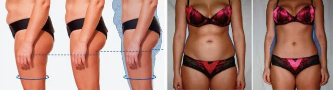 MAG SHAPE