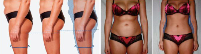 MAG SHAPE